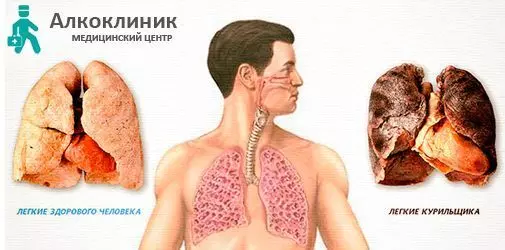Вред курения