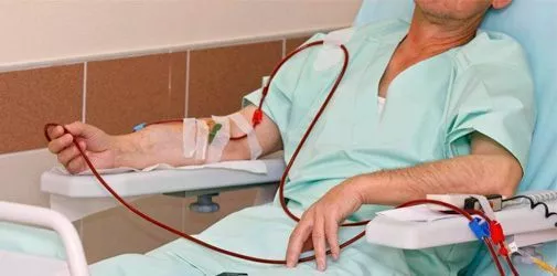 Усовершенствованный мембранный плазмаферез - Алкоклиник